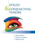 Eyelid & Conjunctival Tumors Eyelid & Conjunctival Tumors